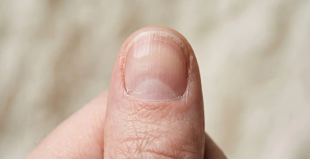 Vue rapprochée d'un ongle naturel sain montrant la structure de la plaque unguéale et des cuticules dans un environnement lumineux et épuré
