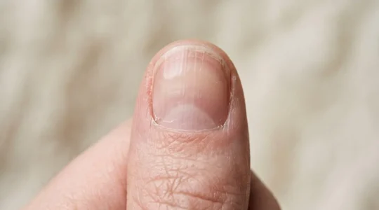 Vue rapprochée d'un ongle naturel sain montrant la structure de la plaque unguéale et des cuticules dans un environnement lumineux et épuré